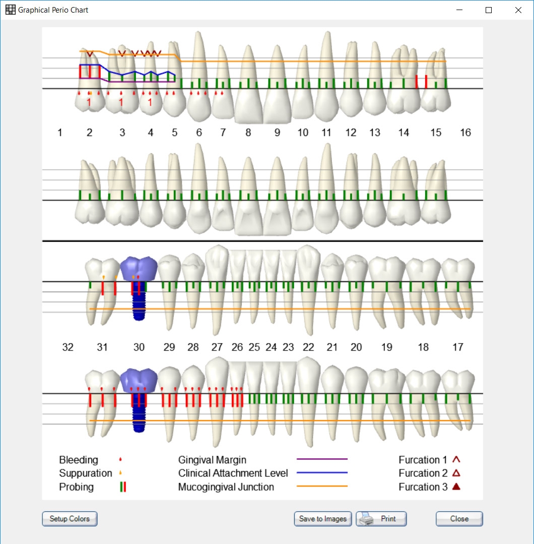 Dental And Perio Charts