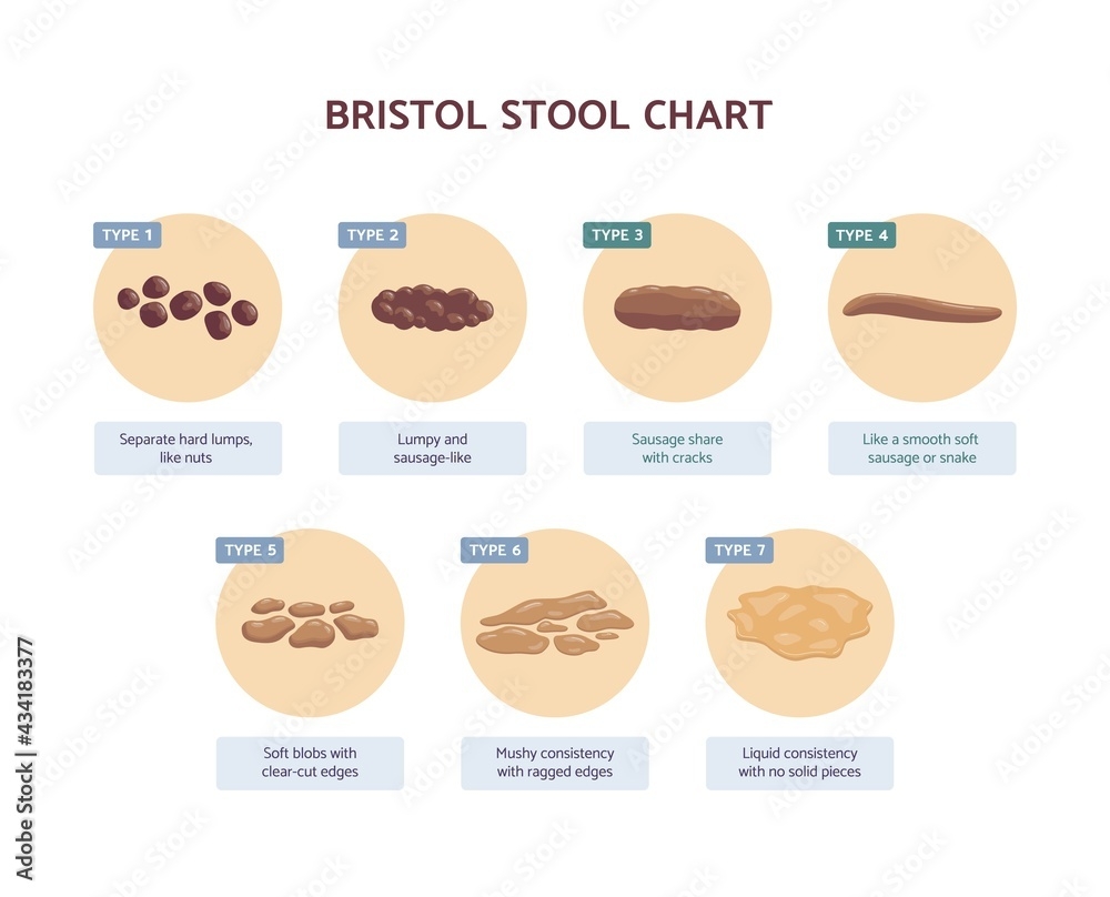 Poster Bristol Stool Chart With Medicine Description Of Human Excrements Wall Art UkPosters